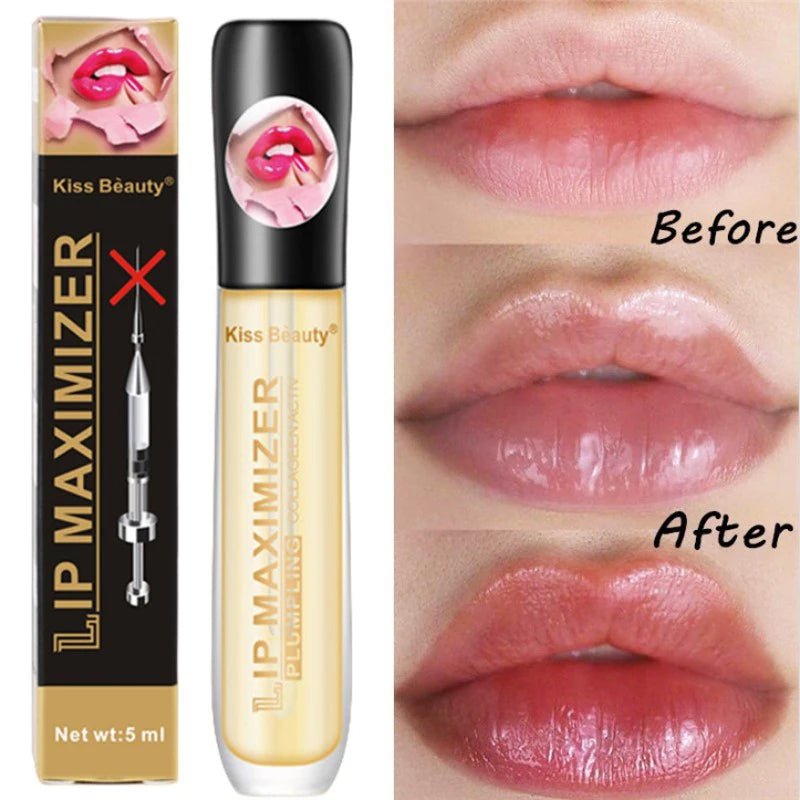 Kiss Beauty™ - Maximizador de labios