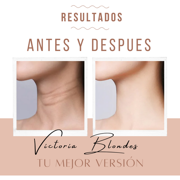 Estimulador Antiedad | Lifting Face Pro